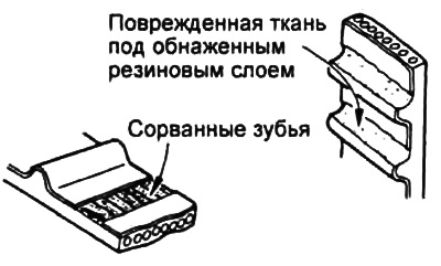 з) Адсутнасць зуба.
